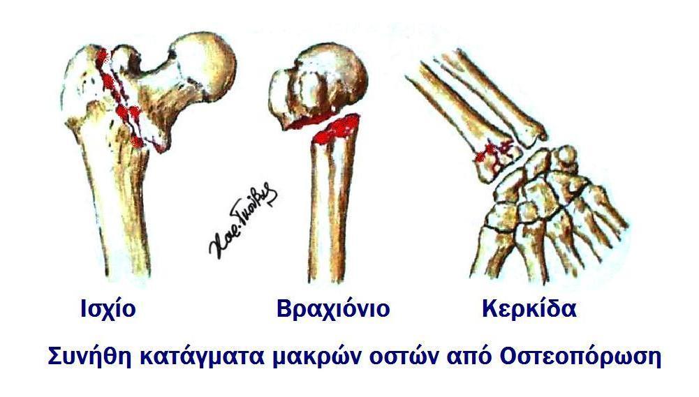 στ) Nα βελτιώσει τη λειτουργία του αναπνευστικού συστήµατος και την καρδιαγγειακή υγεία. ζ) Nα βελτιώσει τη λειτουργική δραστηριότητα του ασθενούς.