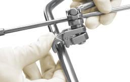 and Knob, have an assistant attach all of the retractor handles to your preferred blades before