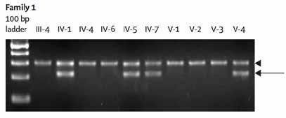 ΝΕΦΡΟΠΑΘΕΙΑ COMPLEMENT FACTOR H RELATED 5 (CFHR5) Κληρονομούμενη νεφρική νόσος