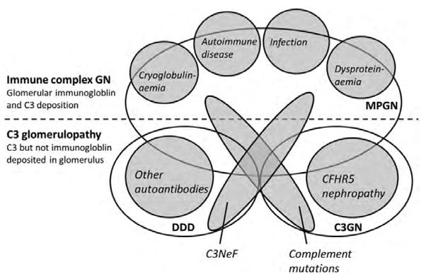 ΝΕΦΡΟΠΑΘΕΙΑ COMPLEMENT FACTOR H RELATED 5 (CFHR5) Αυτοσωματική επικρατούσα μορφή της C3 σπειραματοπάθειας MPGN τύπου II ή DDD (επίκτητες και κληρονομικές διαταραχές της εναλλακτικής οδού