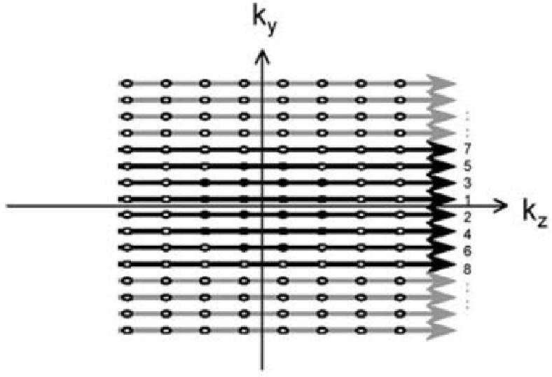 arteriaalse faasi ajal k x 3D k-ruum MR