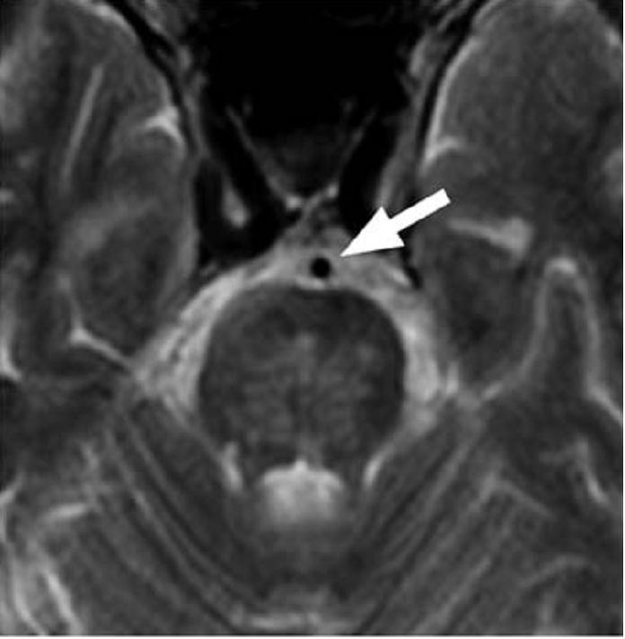 Sissejuhatus MRT angiograafiasse. Sven Telliskivi - PDF Free Download