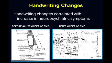 PANDAS Pediatric Autoimmune Neuropsychiatric