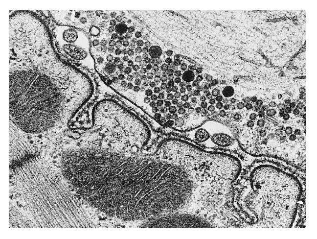 Μεμβρανική εκβλάστηση και σύντηξη Κλαθρίνη: ειδική πρωτεΐνη που πολυμερίζεται σε ένα πλέγμα γύρω από μία