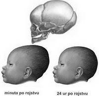 Ob rojstvu se mnoge lobanjske kosti niti ne stikajo, med njimi je razpeto močno vezivno tkivo, ki se še ni začelo zakostenevati.