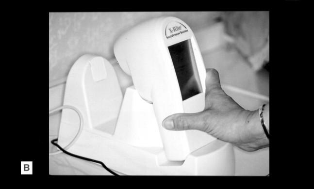 Piesa de mână poziţionată pe suprafaţa dintelui pentru captarea datelor; B.