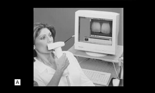 68 FIZIOLOGIA ŞI PATOLOGIA CROMATICII DENTARE