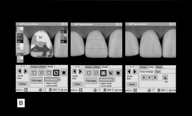 Sistemul SpectroShade: A Înregistrarea culorii