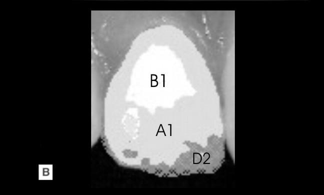 structurilor dentare faţă de radiaţia luminoasă şi pe înţelegerea metodelor de determinare a culorii dinţilor.