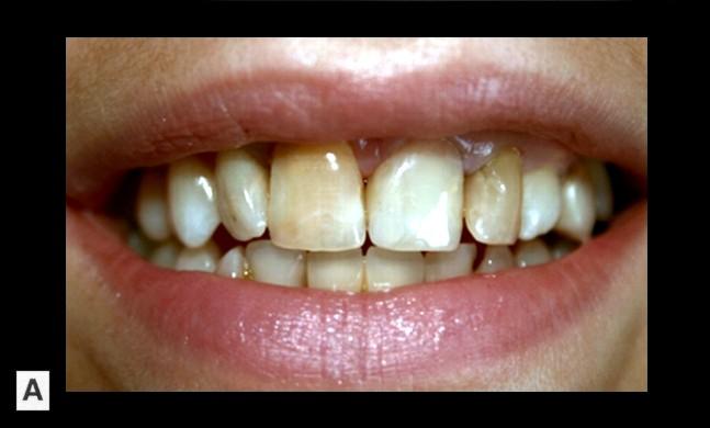 ICII DENTAR