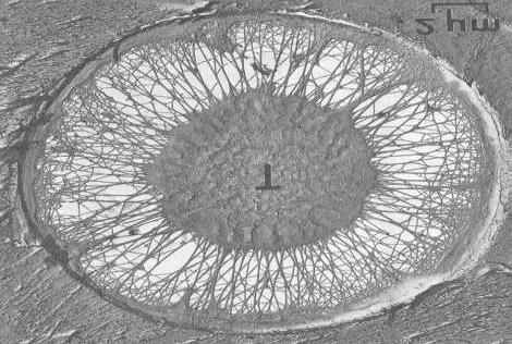 18Γ. Άβακας ΕΙΚ. 18. Δομή κυττταρικού τοιχώματος στο ηλεκτρονικό μικροσκόπιο: (Α): Μέλη αγγείων, διακρίνονται καθαρά σπειροειδείς παχύνσεις.