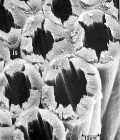 (Γ): Τυπική μικροσκοπική εμφάνιση κυτταρικών τοιχωμάτων σε θλιψιγενές ξύλο. (Δ): Τραχεΐδες θλιψιγενούς ξύλου σε είδος πεύκης, χωρίς στρώση S3 (βλ.