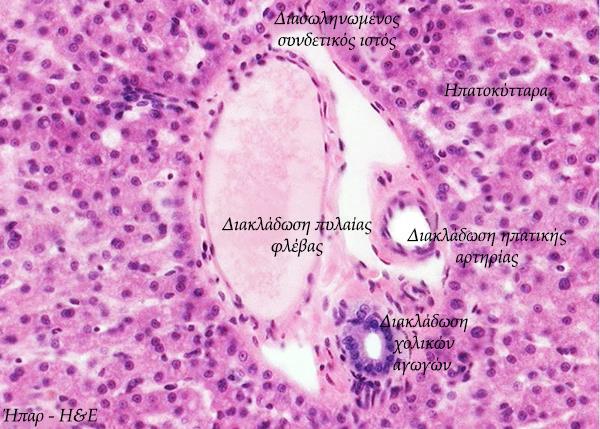 Η NAFLD εκτιμάται ακόμη ότι αντιστοιχεί στο 30% έως 40% των θανάτων σε σχέση με τις υπόλοιπες ηπατικές νόσους.