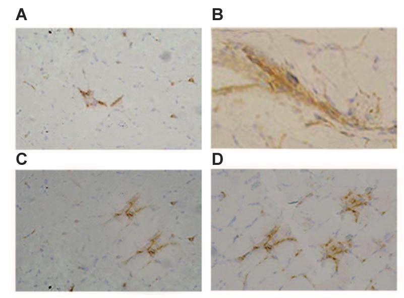 491 ** P, # P ## P (stained in brown) in model rats from the control P < Expression of