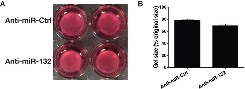Supplementary Figure 11: Mouse dermal fibroblast-mediated collagen gel contraction.