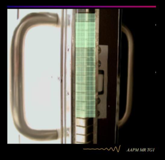 41 Ως προς την ομοιογένεια, παρατηρήθηκε στατιστικά σημαντική διαφορά στην μέση τιμή PIU μεταξύ της κατάστασης αναφοράς και όταν ήταν ανοιχτά τα φώτα της αίθουσας MRI ( Lights DT) (μείωση 3.