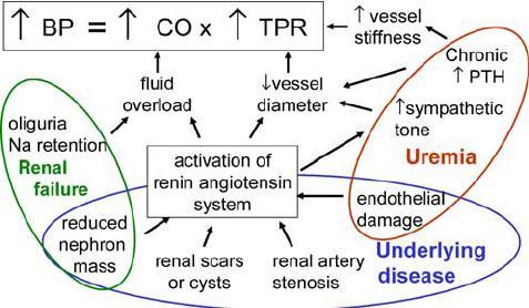 Παθογένεια ανθεκτικής υπέρτασης στη χρόνια νεφρική νόσο I. Κατακράτηση νατρίου - όγκου (5-10% του ΣΒ) II.
