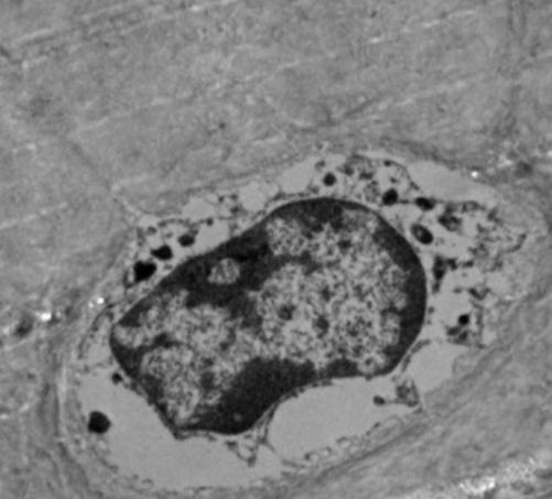 Chondrocyte- Transmission Electron Microscopy