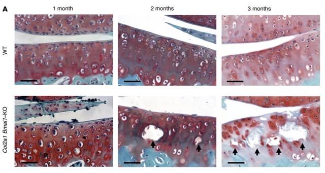 The chondrocyte clock gene Bmal1 controls cartilage