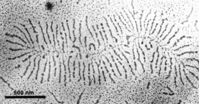 Proteoglycan Fetal proteoglycan aggregate