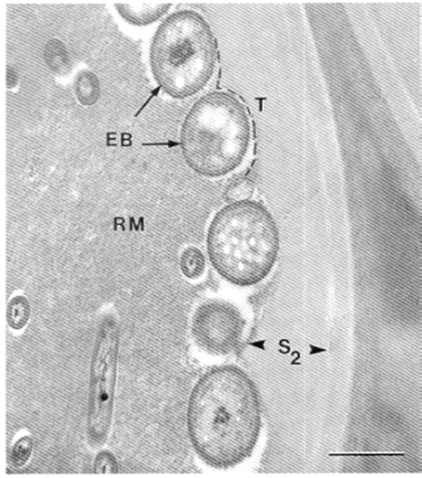 ΔΙΑΒΡΩΤΙΚΑ ΒΑΚΤΗΡΙΑ Α Β Γ A, B: Διαβρωτικά βακτήρια (EB ) σε ξύλο πεύκης