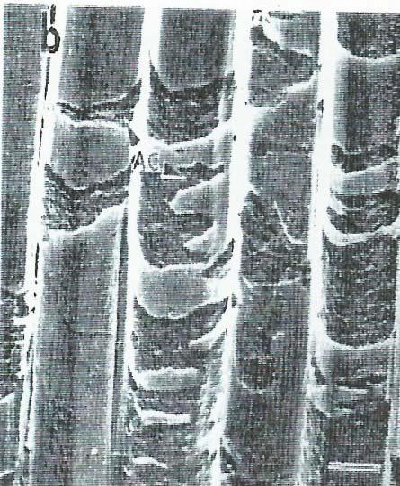 κυτταρικών τοιχωμάτων σε δασική πεύκη σε ηλεκτρονικό (ΤΕΜ)