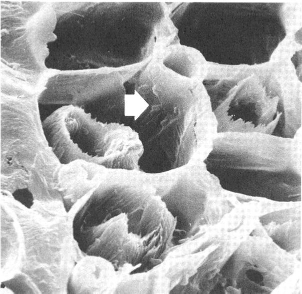 ΒΑΚΤΗΡΙΑ Α Β Γ Μικροσκοπική εμφάνιση προσβολής από βακτήρια των κυτταρικών