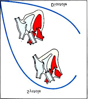 Volum Sistolic (DC) 3. Presarcina (P 1 ) Sistola Diastola l i (VEDV) Parametru diastolic determină volumul (VEDV) şi presiunea (VEDP) intracavitară înainte de contracţie.