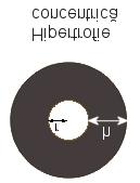 Tipuri de hipertrofie cardiacă Concentrică (în HTA sau stenoză aortică) la solicitarea