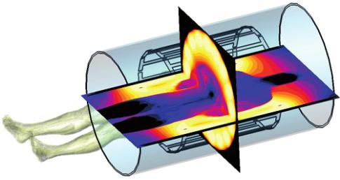 Poleg statičnega magnetnega polja je za vzbujanje atomov med slikanjem potreben tudi kratek pulz močnega visokofrekvenčnega EMS (10 400 MHz), katerega moč lahko dosega do 35 kw v pulzu, uporabljajo