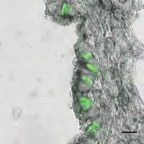 5) πραγµατοποιήθηκε in situ υβριδοποίηση για την ανίχνευση