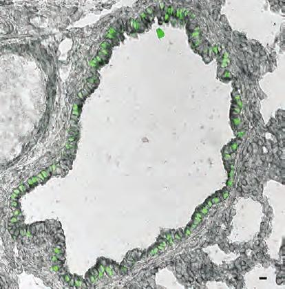 Παρατηρείται έκφραση του mrna των GemC1 και McIdas στο