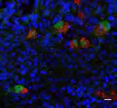 GFP/Foxj1 GFP/Foxj1 Δ