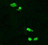 PCNT GFP/PCNT Εικόνα 4.2.