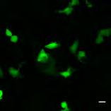 GFP GemC1 n=325 n=527 *** * Δ Ποσοστό Foxj1+GFP+/GFP+ κυττάρων 25 20 ALI DAY 3 GFP GemC1 McIdas