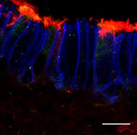 4. ΑΠΟΤΕΛΕΣΜΑΤΑ B GemC1 WT/WT GemC1 KO/KO ACT/γ-tubulin/E-cadherin Εικόνα 4.4.3 Η έλλειψη του γονιδίου GemC1 εµποδίζει τη δηµιουργία των πολυκροσσωτών κυττάρων του αναπνευστικού επιθηλίου.