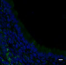 Οι p73 (Marshall et al, 2016; Nemajerova et al, 2016) και Foxj1 (Brody et al, 2000; Stubbs et al, 2008; Yu et al, 2008) µεταγραφικοί παράγοντες συµµετέχουν αργ