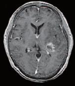10,17 FDG T/N