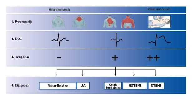 Početna procjena pacijenata sa sumnjom na akutni koronarni sindrom Početna procjena se zasniva na integraciji kliničke prezentacije (npr: simptomi, vitalni znakovi), 12-kanalni EKG i srčani troponin.