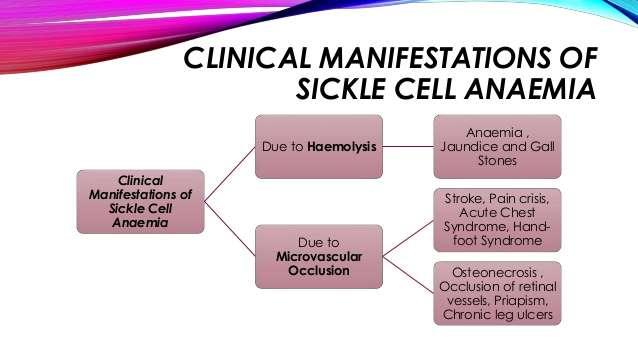 Sickle cell