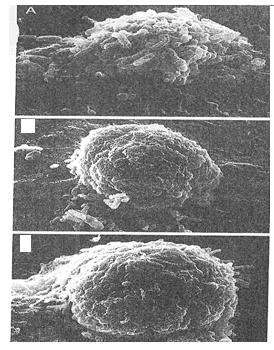 ενδοκυττάρια λοίμωξη στον άνθρωπο Εκκριτικό σύστημα VirB11/VirB4 ο