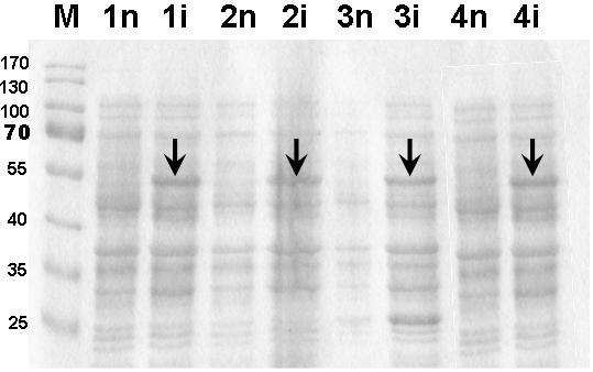 Obr. 2: Analýza expresie Faktora X v bunkových lyzátoch E. coli (M) marker molekulových hmotností [kda]. 6.) Váš proteín označte na Obr.