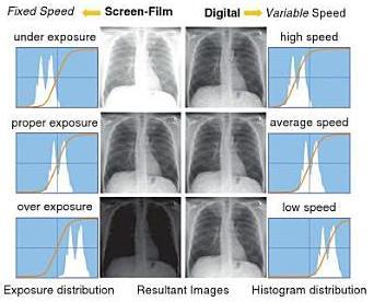 Ψηφιακή επεξεργασία εικόνας: Αντιμετώπιση υποέκθεσης/υπερέκθεσης Σταθερή ταχύτητας του συστήματος