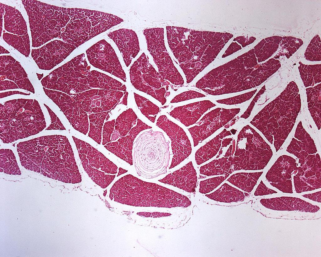 PANCREAS - glandă mixtă - nu are capsulă propriu-zisă