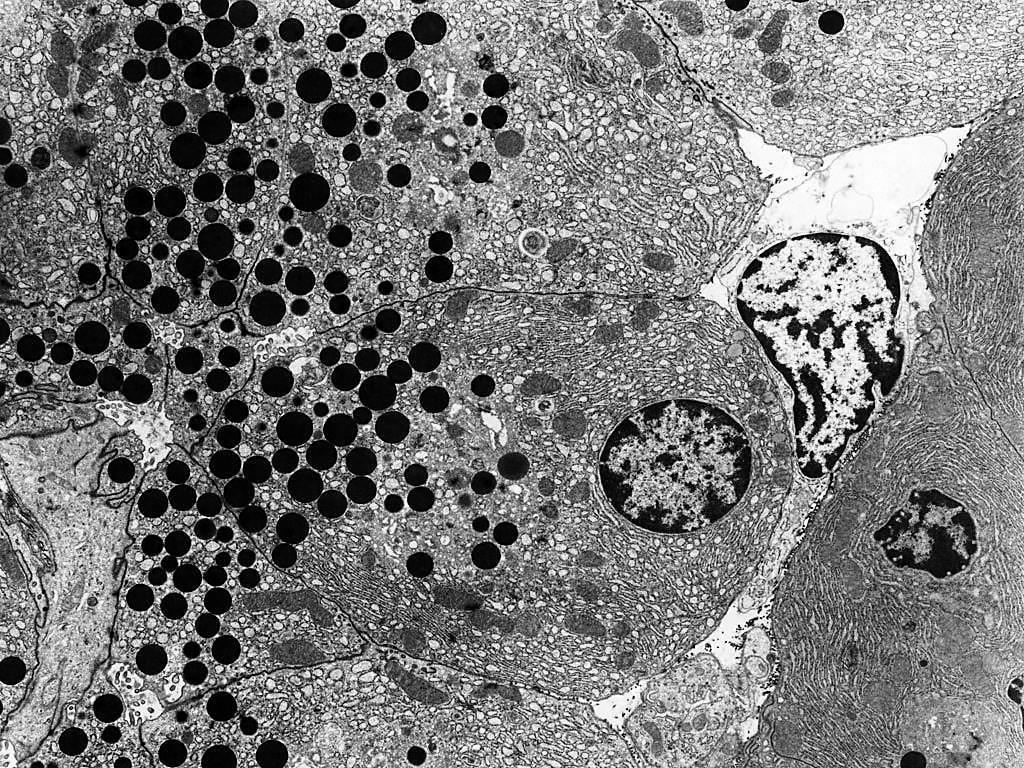 PANCREASUL EXOCRIN Parenchim format din: 1.