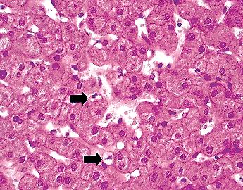 Celule perisinusoidale Ito (celule hepatice stelate, lipocite) origine număr: 5-8%