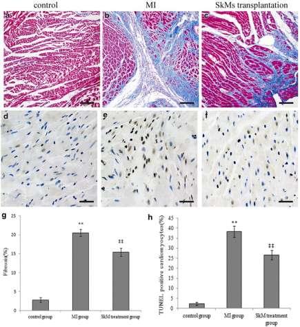 μεταξύ αυτών τα mirna-100, mirna-101, mirna-132, mirna-15b,mirna- 20a, mirna-92a βρέθηκαν να ενισχύουν την απόπτωση με στοχοθέτηση αρνητικοί ρυθμιστές/παράγοντες στην ενδογενή οδό απόπτωση.