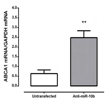 Α Β Γ Δ Εικόνα 51: Μεταγραφική έκφραση του mir-10b (Α) σε καλλιέργειες ΑΚΑ-ΛΜΚ μετά από τη χορήγηση 100nmol/lt anti-mir-10b για 48h.