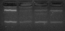 Προσθήκη 0,5ml κρύας ισοπροπανόλης για κάθε ml Trizol με στόχο την κατακρήμνιση του RNA Επώαση για 10 λεπτά στους 15-30 ο C σε υδατόλουτρο Φυγοκέντρηση στις 13000 στροφές για 10 λεπτά στους 2-8 ο C