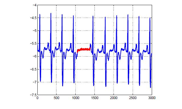 Σχήμα 3: Collective anomaly corresponding to an Atrial Premature Contraction in a human electrocardiogram output. 1.